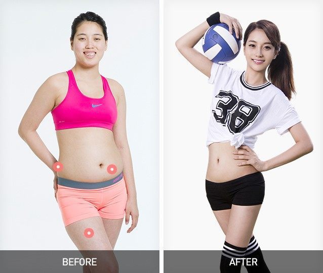 Las 10 transformaciones más sorprendentes de las cirugías plásticas en Corea!